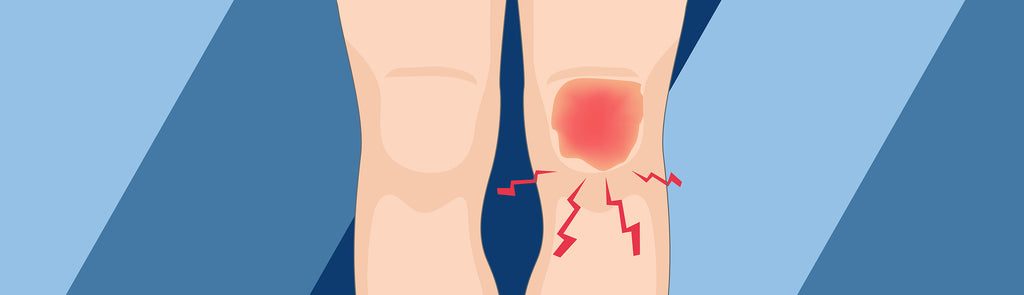 Achilles and sales knee pain